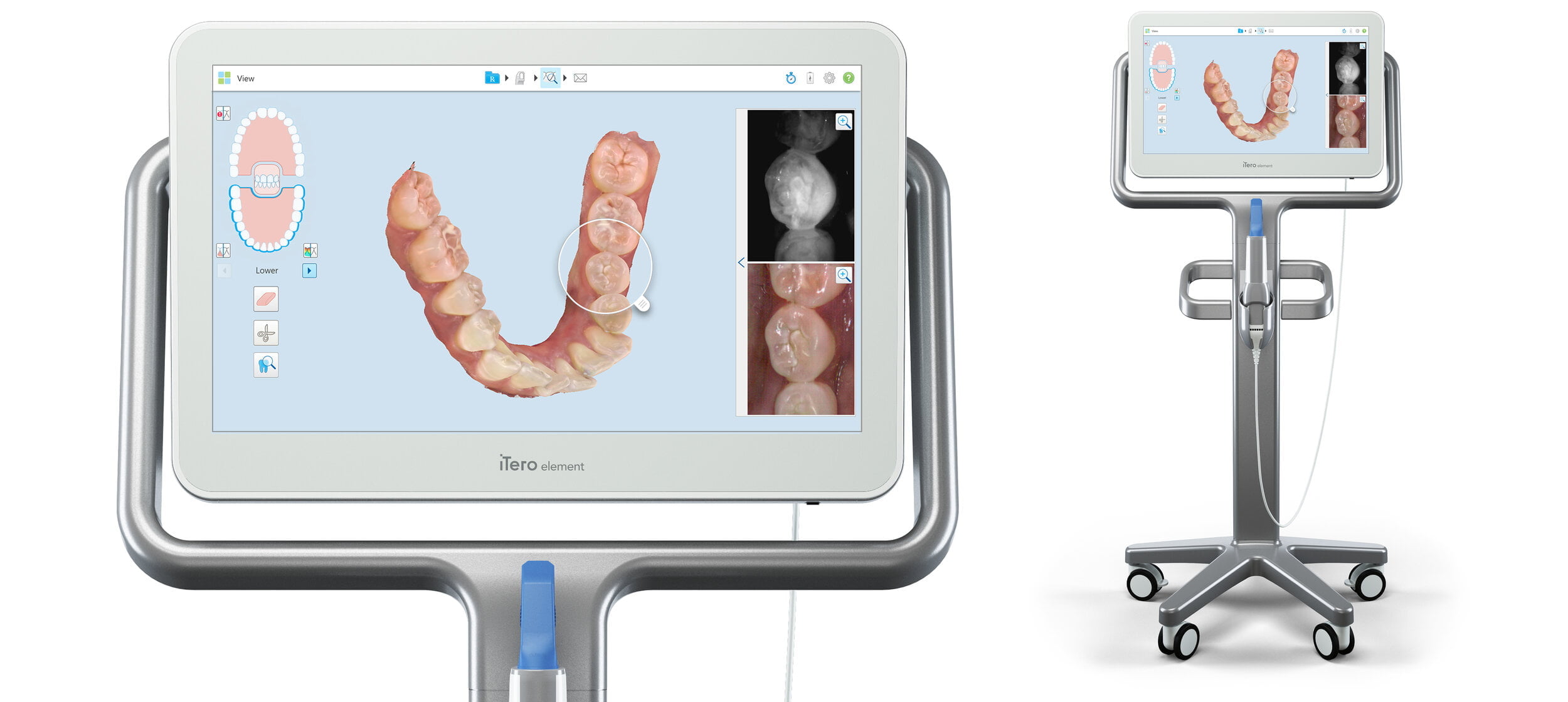 Digital impressions are made using an Itero scanner, so you can skip the traditional 